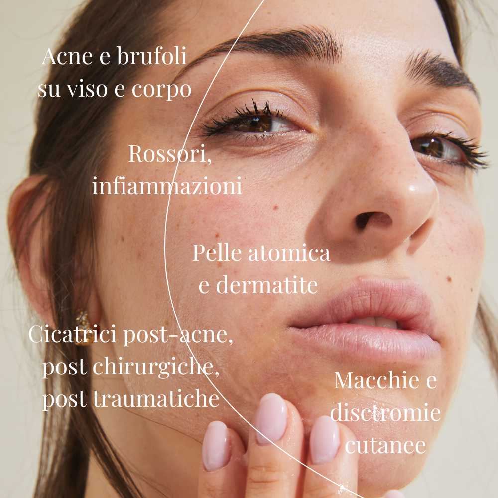 Skin Perfect - Gel viso e corpo