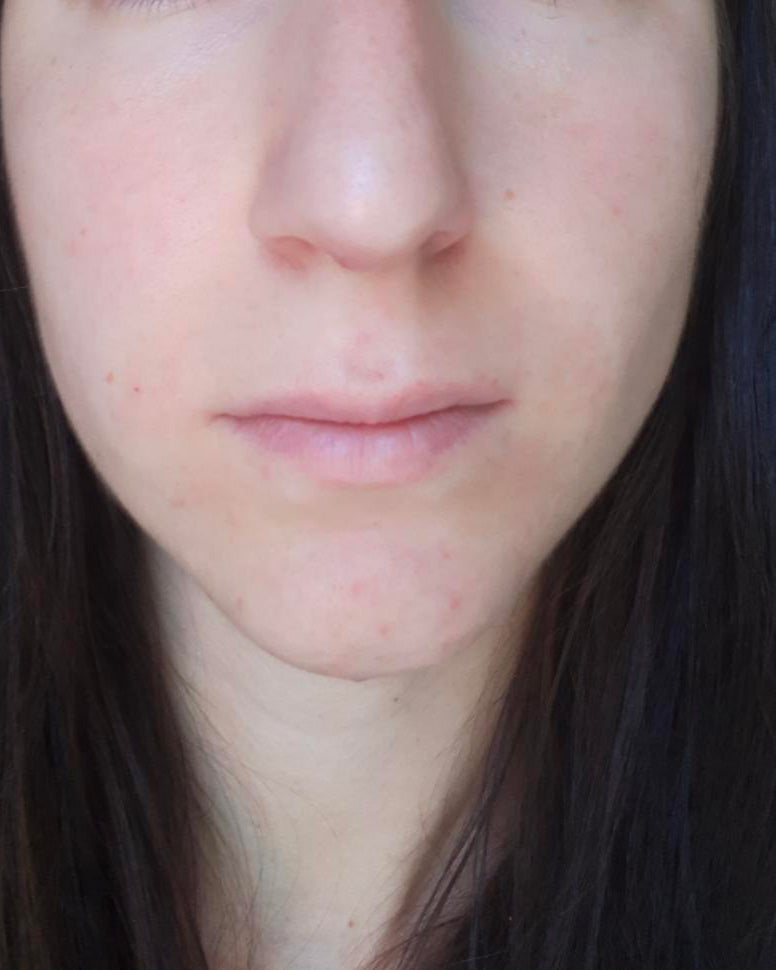After